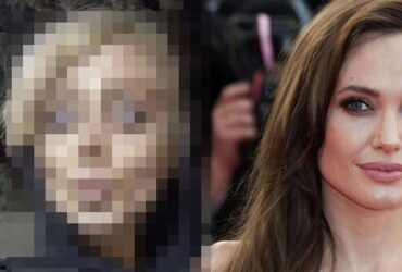 Angeline Jolieye benzemek icin servet harcadi Iste son hali