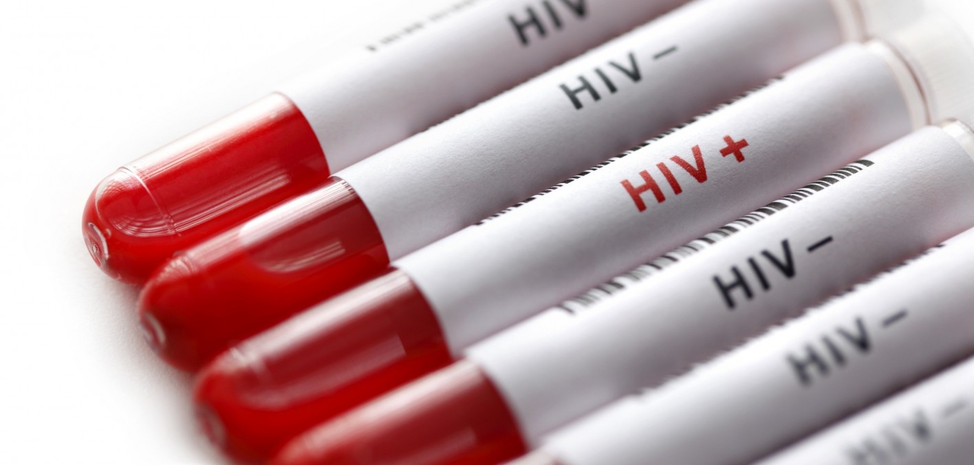 HIV aşısı