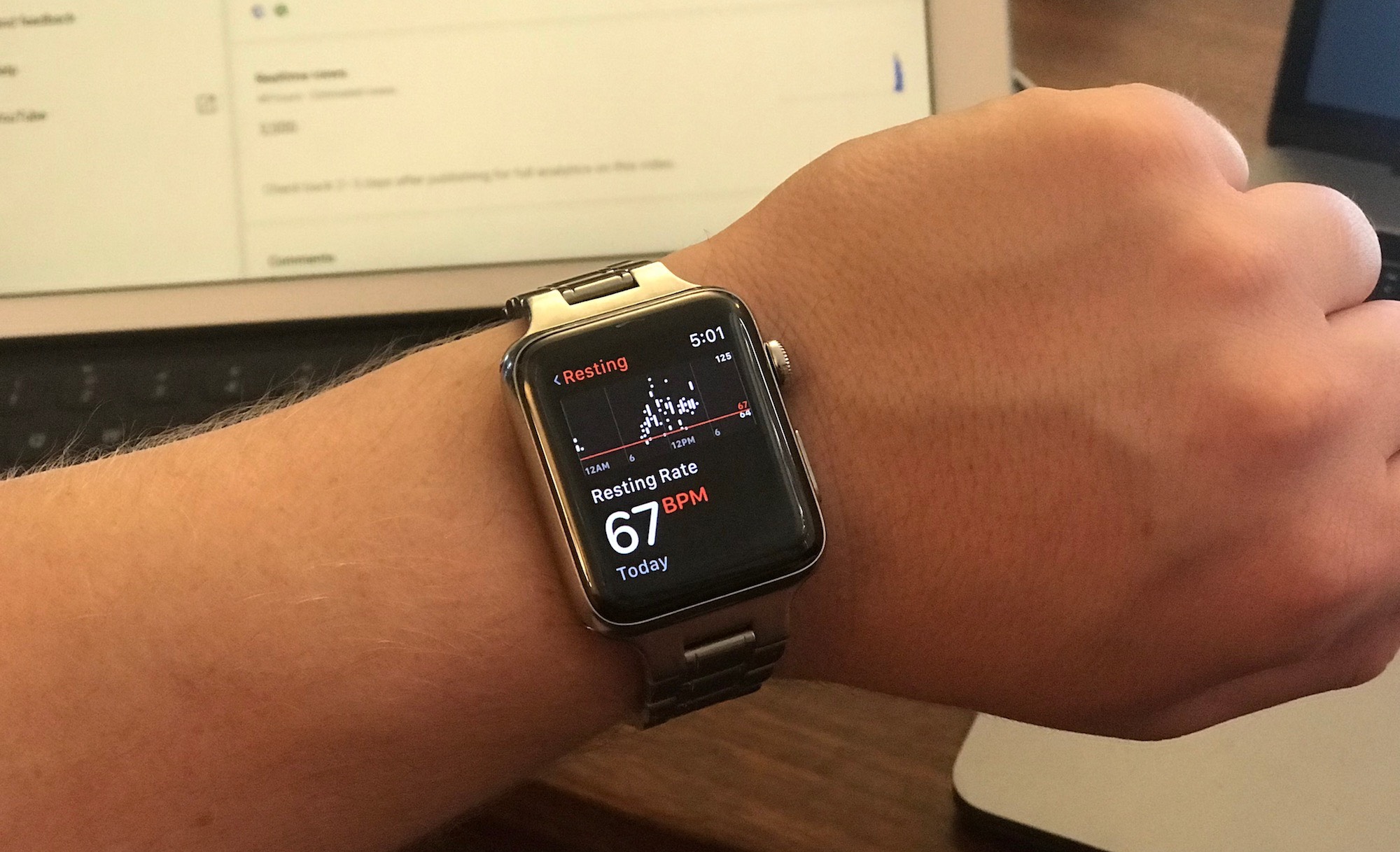 Apple Watch, kalp sorununu algılayarak bir hayat daha kurtardı