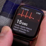 Apple Watch EKG Uygulaması Önemi Nedir?