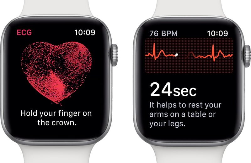 Apple Watch EKG Uygulaması Önemi Nedir?